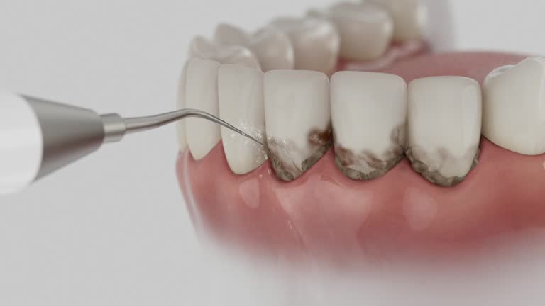 Trusted Root Canal Treatment service in Harvey, LA - Dentist Open Now